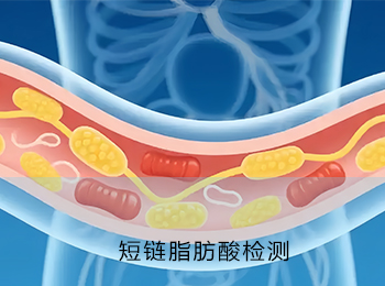 短链脂肪酸检测